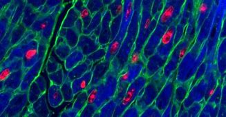 Image result for Heart Cancer Cells