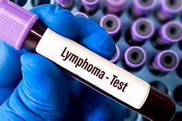 Image result for Lymphoma Panel