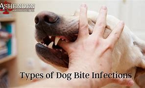 Image result for Tetanus From Dog Bite