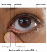 Image result for Lacrimal Papilla