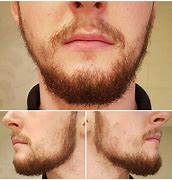 Image result for Thin Beard