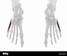 Image result for M Flexor Digiti Minimi Brevis