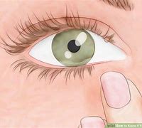 Image result for Eyebrow Mites On Humans