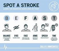 Image result for Be Fast Stroke Cards