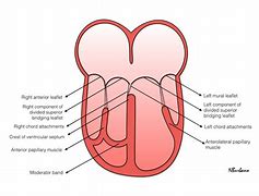 Image result for Unbalanced AV Canal