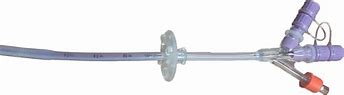 Image result for PEG Tube Replacement