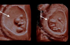 Image result for Baby Scan 3D 4D