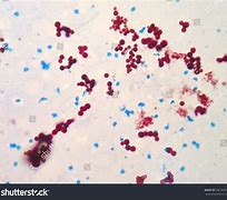 Image result for Mycobacterium in Fish