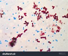 Image result for Mycobacterium Piscium Fish