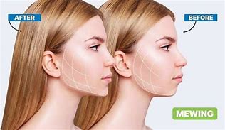 Image result for Mewing Mask