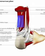 Image result for Area Distal to Lateral Malleolus