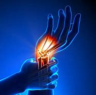 Image result for Wrist Injury