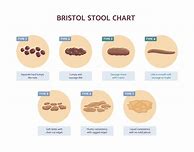 Image result for Know Your Poop Chart