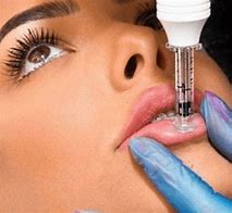 Image result for Hylauronic Pen Lip Filler