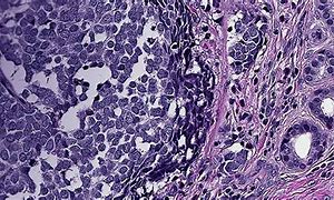 Image result for Pathology Images