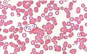 Image result for Thrombosis Histology