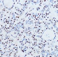 Image result for SSB Antibody