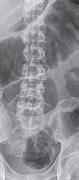 Image result for IRM Abdominal