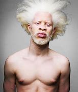 Image result for White Albino Africans