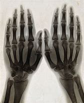 Image result for Normal Hand Radiograph