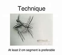 Image result for Temporal Artery Biopsy Technique