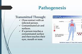 Image result for Severe Acute Respiratory Syndrome