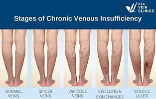 Image result for Venous Plexuses