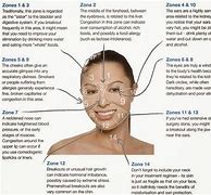 Image result for Acne Boy Face Map