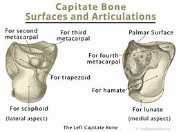 Image result for Capitate Bone Pain