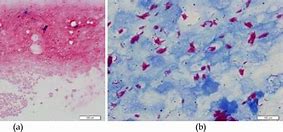 Image result for Mycobacterium GM's Stain