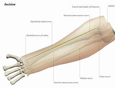 Image result for Volar vs Dorsal