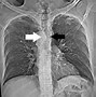 Image result for Aortic Vessels