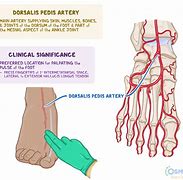 Image result for Wheer Is the Dorsal Pedal