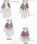 Image result for Ventral Aspect of Wrist