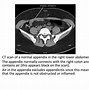 Image result for CT Scan PPT Template