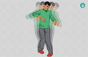 Image result for Ataxia Clip Art