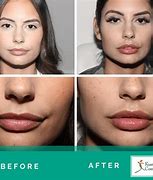 Image result for Lip Reaidng