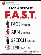 Image result for Stroke Fast AHA