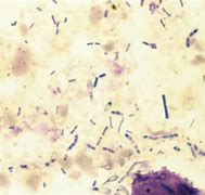 Image result for Food Granules in Fecalysis