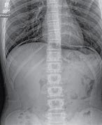 Image result for IRM Abdominal