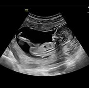 Image result for 13 week baby development