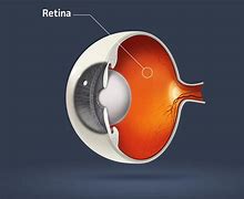 Image result for Eye Ball Anatomy Retina