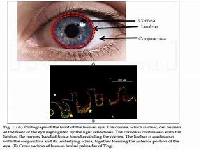 Image result for Limbus Cornea