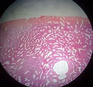 Image result for Uteres Histology