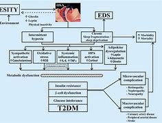 Image result for Diabetes and Osa