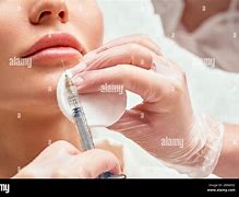 Image result for Lip Call Us