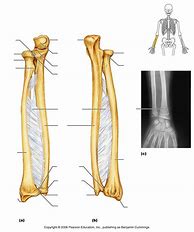 Image result for Open Diagram of Bone