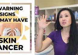 Image result for 5 Warning Signs of Skin Cancer