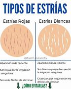 Image result for Caro Que Tiene Una Estrya