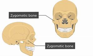 Image result for Zygomatic Smile